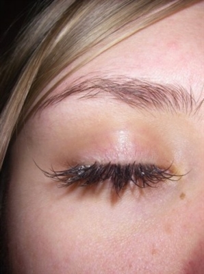 Is eyelash extensions harmful?